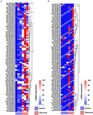 Expression of microRNAs related to apoptosis in the aqueous humor and lens capsule of patients with glaucoma